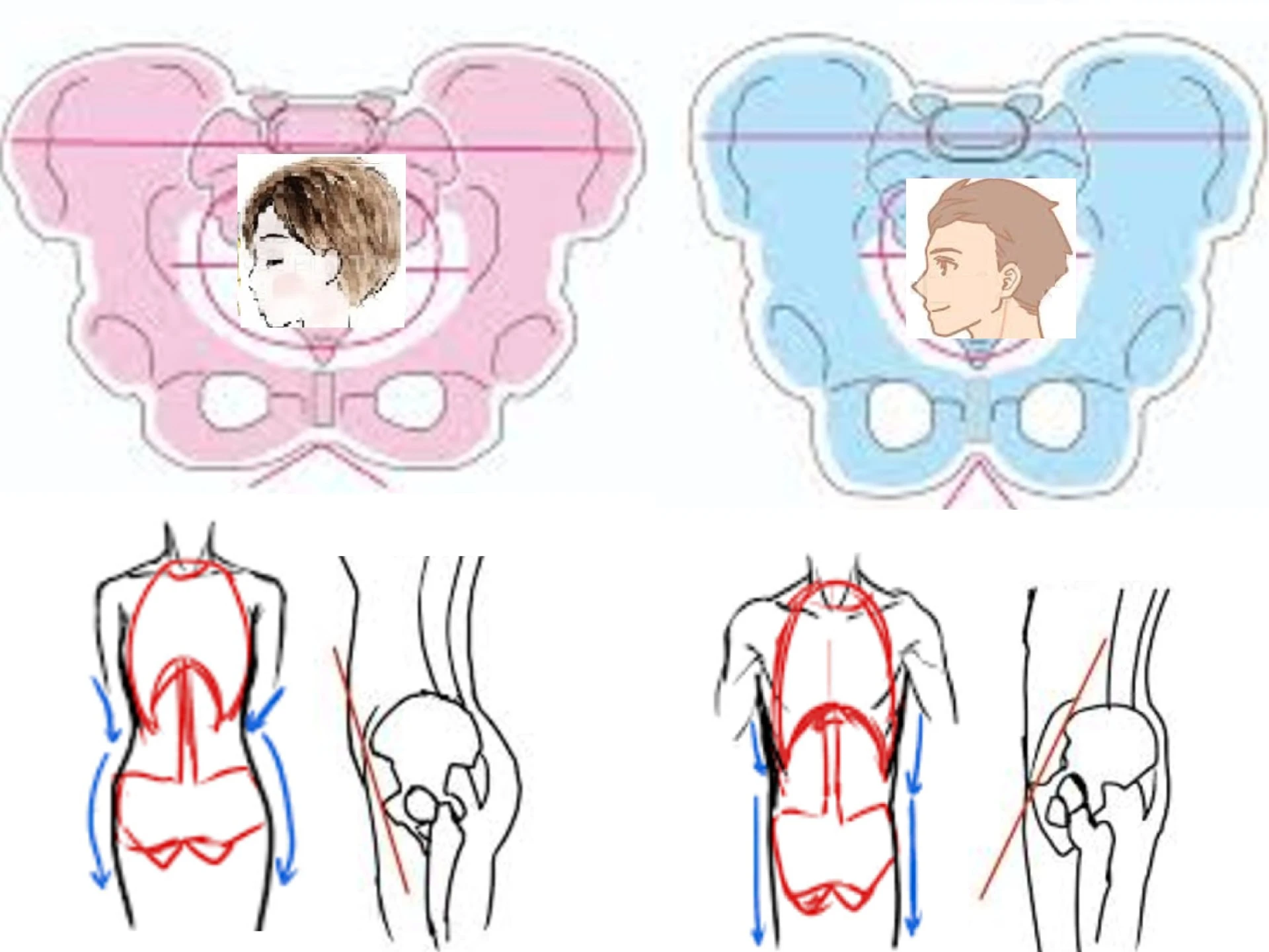 骨盤顔の比較